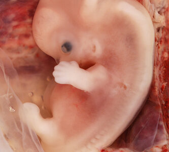 少子化対策メモ　出生数と中絶数に関する相関関係　日本人女性の6人に1人は「人口妊娠中絶」の経験がある。厚生労働省