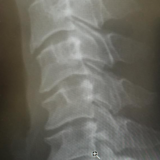 なぜ？医者はレントゲン写真をスマホで撮られるのを嫌がるのか？