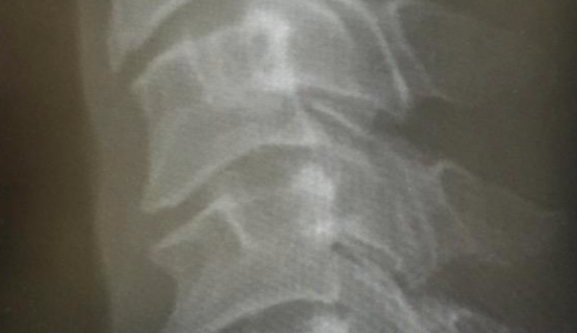 なぜ？医者はレントゲン写真をスマホで撮られるのを嫌がるのか？