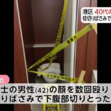 枝切りハサミでチョッキンされるリスクを考えよう…。なぜ？報道は「局部」を「下腹部」とやわらげたのだろう…